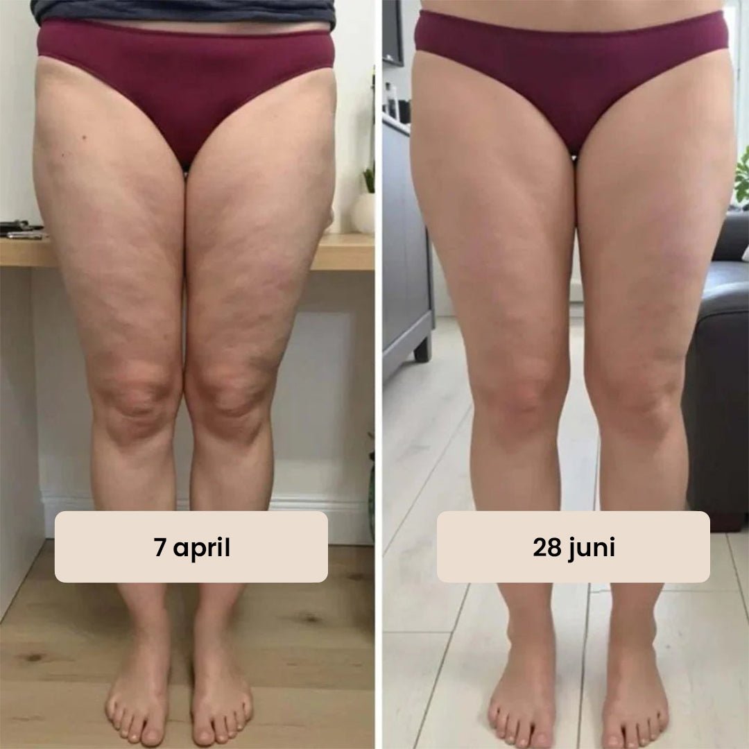 Seamless Anti Cellulite Leggings - Gymfit